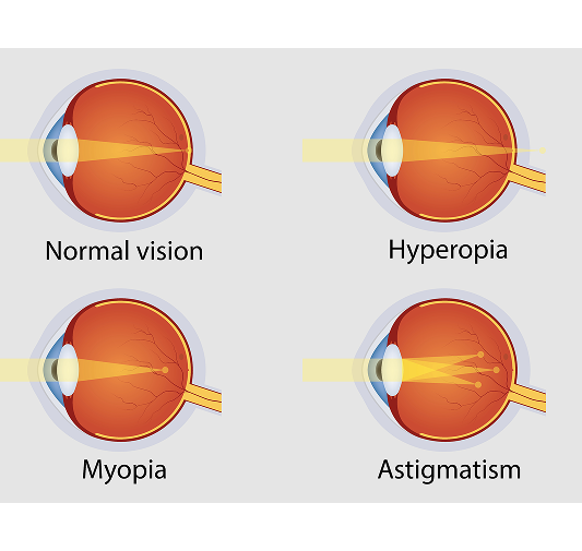 comprehensive eye examination of missouri eye consultants